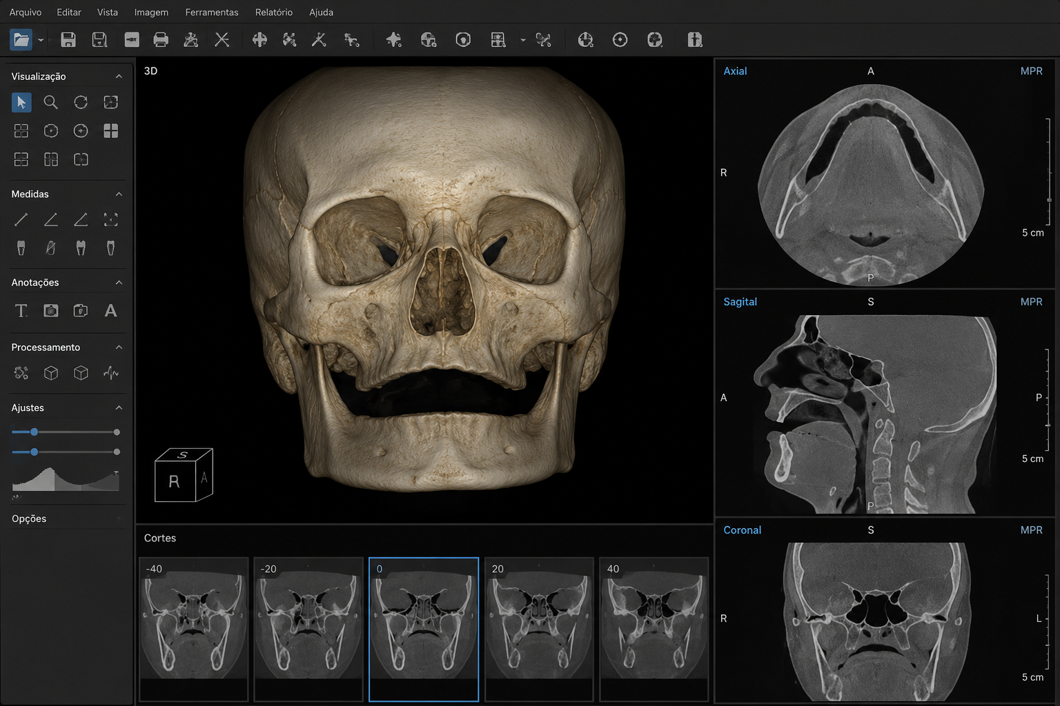 Equipamento de tomografia digital computadorizada na clínica Odontologia Velasco